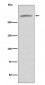 Anti-VWF/Von Willebrand Factor Rabbit Monoclonal Antibody